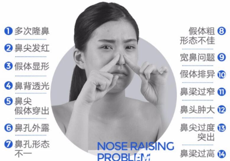 隆鼻手術(shù)失敗的癥狀