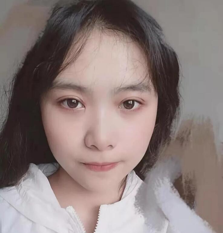 圓臉適合弧形雙眼皮