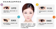 微創(chuàng)雙眼皮是如何做的？果能保持多長時(shí)間？