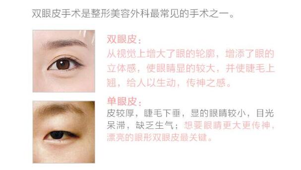 微創(chuàng)雙眼皮是如何做的？果能保持多長時(shí)間？