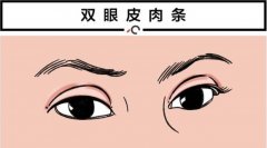 雙眼皮失敗較多能修復(fù)幾次？看專業(yè)醫(yī)美人士怎么說