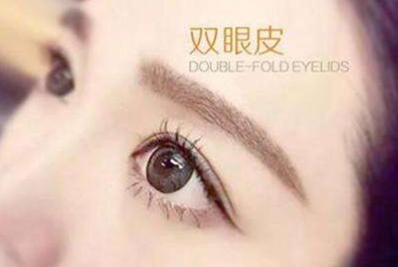 埋線法雙眼皮手術(shù)果維持時(shí)間為3-5年