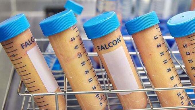 水動(dòng)力吸脂方面有著嫻熟的手法，能夠平穩(wěn)快速且精細(xì)輕柔地把脂肪量吸出來