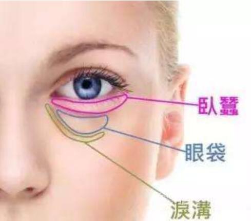 做脂肪填充臥蠶果能撐多久?