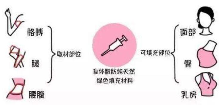 在做脂肪填充臥蠶手術時，所選用的都是自身的脂肪組織