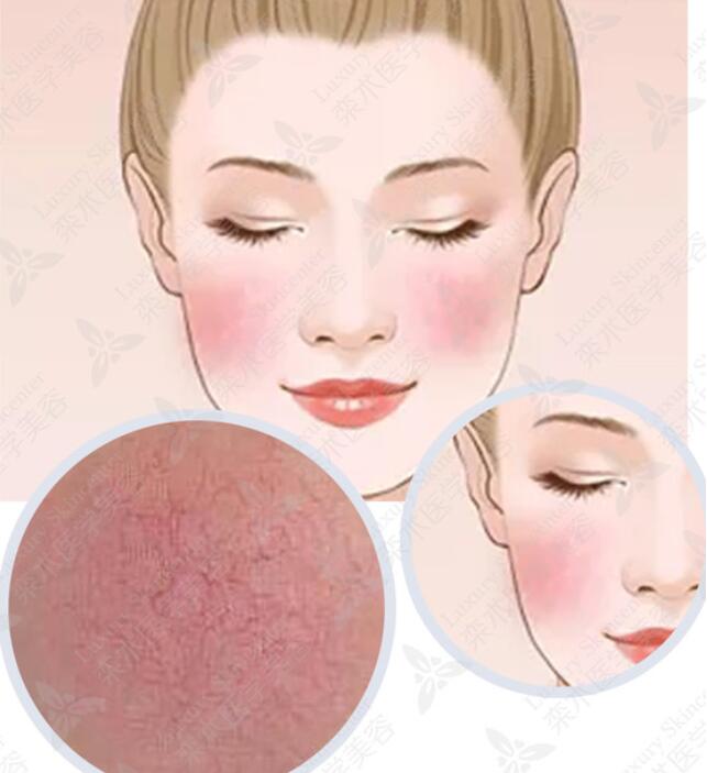 敏感的皮膚?天生的?后天?