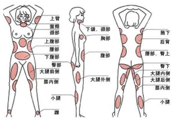 可以做吸脂手術(shù)的部位