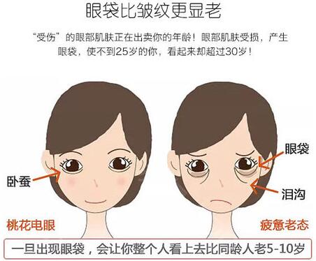 小小年紀(jì)就會(huì)有祛眼袋？外切做眼袋手術(shù)確實(shí)需要認(rèn)識(shí)下！