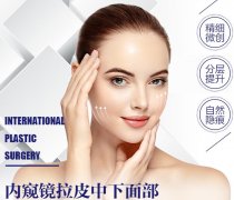 多方位分析內(nèi)窺鏡除皺術(shù)，這些你認(rèn)識(shí)多少？