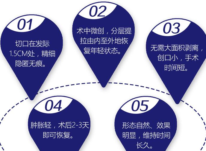 多方位分析內(nèi)窺鏡除皺術(shù)，這些你認(rèn)識(shí)多少？