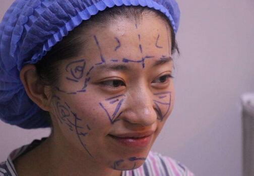 吳明瑞醫(yī)生比較擅長自體脂肪移植、新題塑形、面部五官年輕化