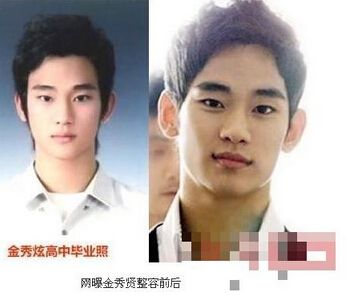 金秀炫整容了沒(méi)有？美小編來(lái)詳細(xì)盤(pán)點(diǎn)一下