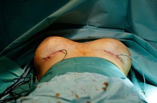 成都隆胸醫(yī)生哪個(gè)好