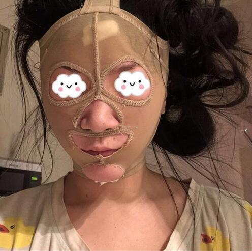 吸脂瘦臉手術(shù)果怎么樣？吸脂瘦臉和溶脂哪個好？