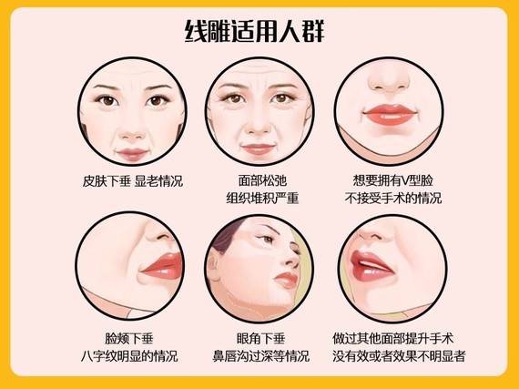 想知道北京面部提升多少錢？看一下詳細(xì)的數(shù)據(jù)