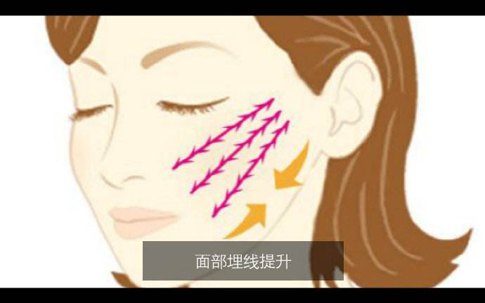 想知道北京面部提升多少錢？看一下詳細(xì)的數(shù)據(jù)