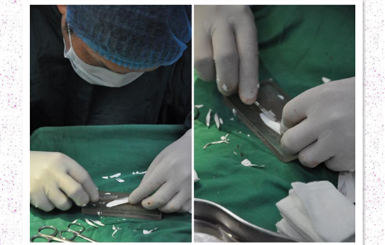 北京膨體隆鼻多少錢(qián)？聽(tīng)說(shuō)膨體容易感染是真的嗎？