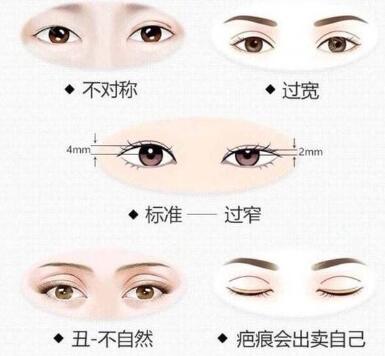 想知道雙眼皮修復(fù)前后能改良哪些問(wèn)題？主要有這些