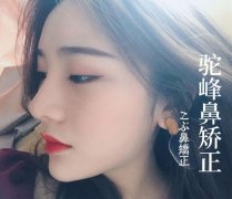 駝峰鼻修復(fù)知識(shí)全科普，來看看適合你嗎？