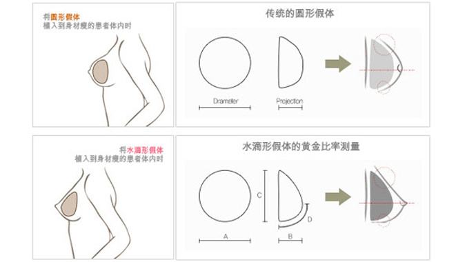 做了胸部乳房假體植入手術(shù)調(diào)節(jié)以后的護理指導