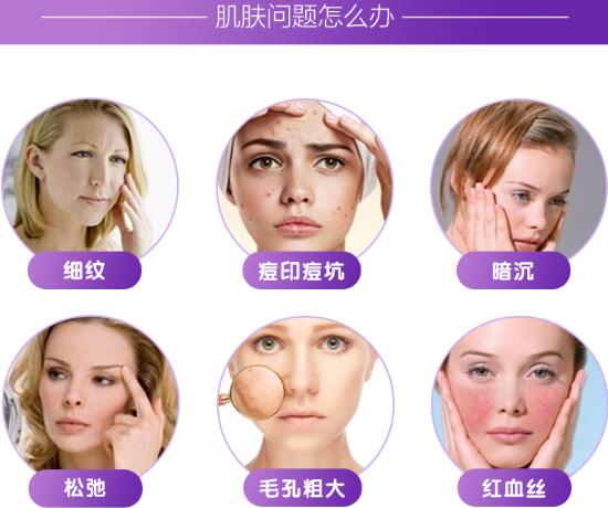 誰做過復合彩光嫩膚？做過以后擺脫數(shù)年的雀斑