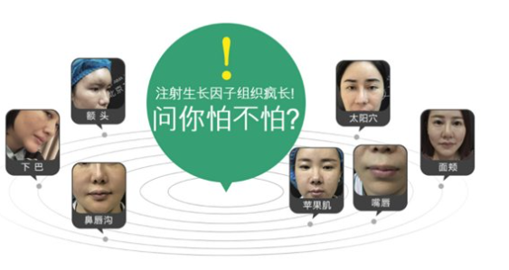 填充以后的不良反應(yīng)，勸你抓緊取出來(lái)