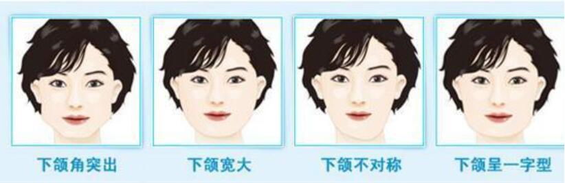擁有一張瓜子臉對(duì)人來(lái)說(shuō)真的很重要，因?yàn)橐粋€(gè)巴掌大的臉看起來(lái)會(huì)較為的精致，而且對(duì)自己的整體形象也會(huì)有所幫助
