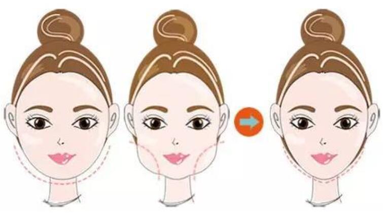 做下頜角磨骨手術(shù)其實也沒有那么可怕！