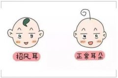 招風(fēng)耳手術(shù)多少錢？普通家庭能夠承受手術(shù)費用嗎