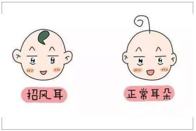 如果要進(jìn)行招風(fēng)耳手術(shù)調(diào)節(jié)，那招風(fēng)耳手術(shù)多少錢(qián)呢