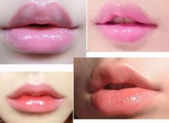 豐嘴唇用什么辦法比較好?玻尿酸or自體脂肪如何選擇