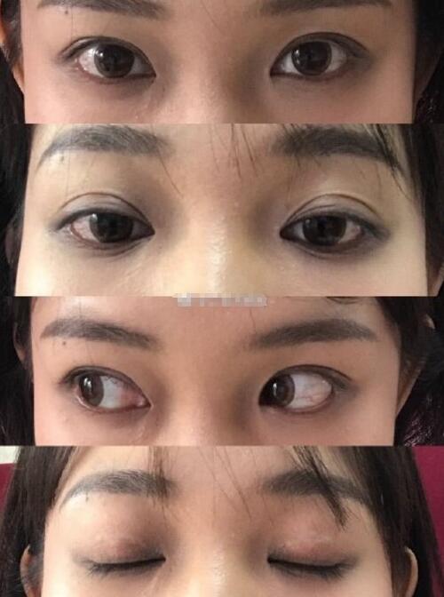 郴州市雅韓張文友醫(yī)生_介紹_實例圖_信譽口碑