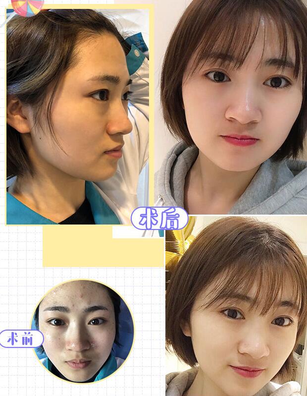 黑臉娃娃果圖，這些獨(dú)到之處怪不得受人寵溺