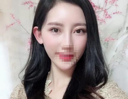 北京協(xié)和醫(yī)院整形外科怎么樣 果圖