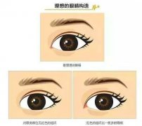 開內(nèi)眼角哪里好？想要做開眼角手術(shù)該如何選擇醫(yī)院