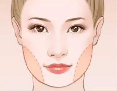 做完面部抽脂手術(shù)多久能恢復(fù)？恢復(fù)期的注意事項~