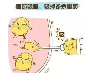 做完面部抽脂手術(shù)多久能恢復(fù)？恢復(fù)期的注意事項~