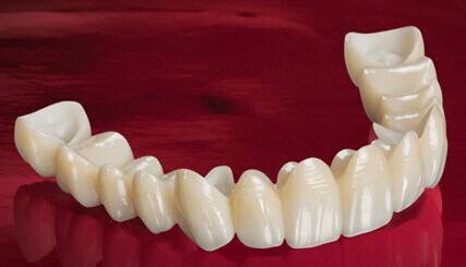 美容冠多少錢一顆？美容冠的缺點(diǎn)讓牙齒成為不可逆的傷害