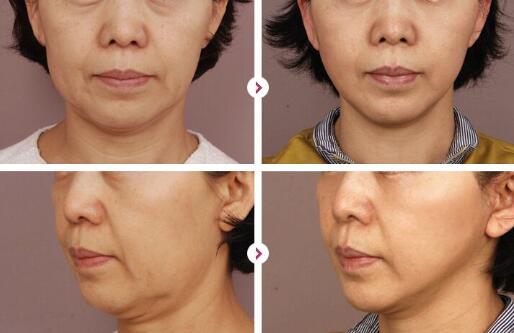 一次的熱瑪吉的保持時間?