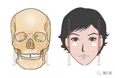 磨骨手術(shù)對比