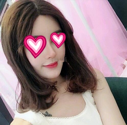 廣西中醫(yī)藥大學(xué)第一附屬醫(yī)院整形隆鼻案例