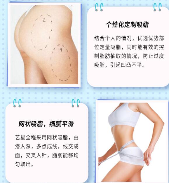 大腿臀部吸脂手術(shù)的醫(yī)院哪家好呢?