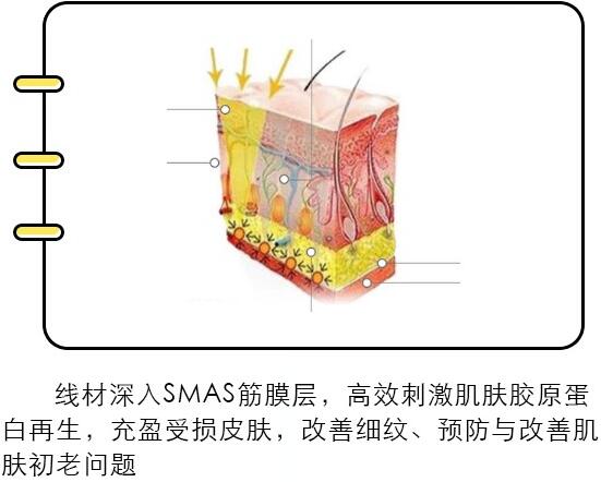 湯芳芳醫(yī)生埋線提升技術(shù)