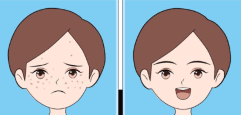 激光祛斑一次多少錢？祛斑美白應(yīng)按療程來進(jìn)行！