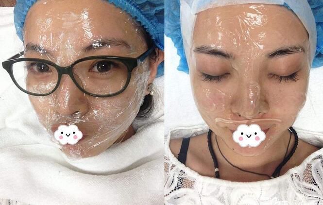 宋瑜醫(yī)生祛斑果圖