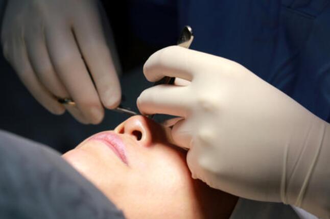 埋線雙眼皮多久恢復(fù)