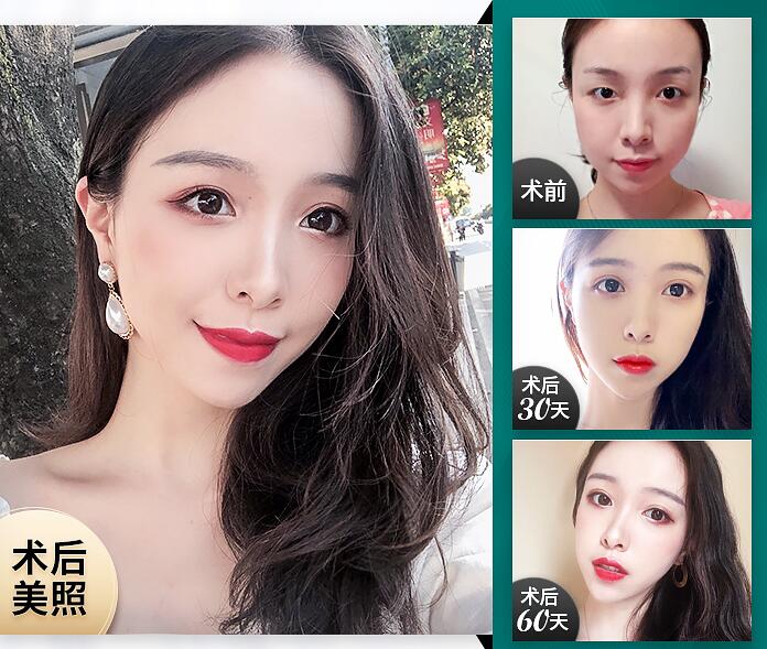 徐艷醫(yī)生技術(shù)好不好 案例圖