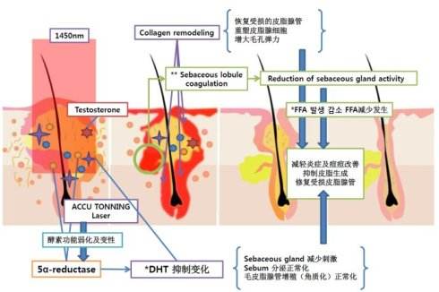 水楊酸祛痘痘、痘印真的有果嗎？敏感肌我勸你別嘗試！