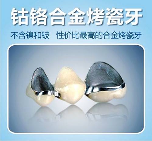 種類(lèi)太多，來(lái)講講鈷鉻合金烤瓷牙的優(yōu)缺點(diǎn)