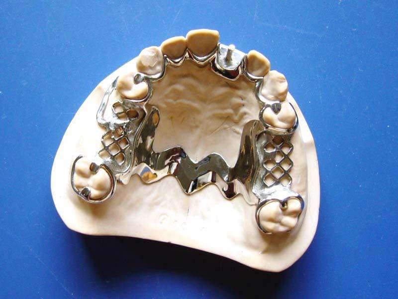 種類(lèi)太多，來(lái)講講鈷鉻合金烤瓷牙的優(yōu)缺點(diǎn)